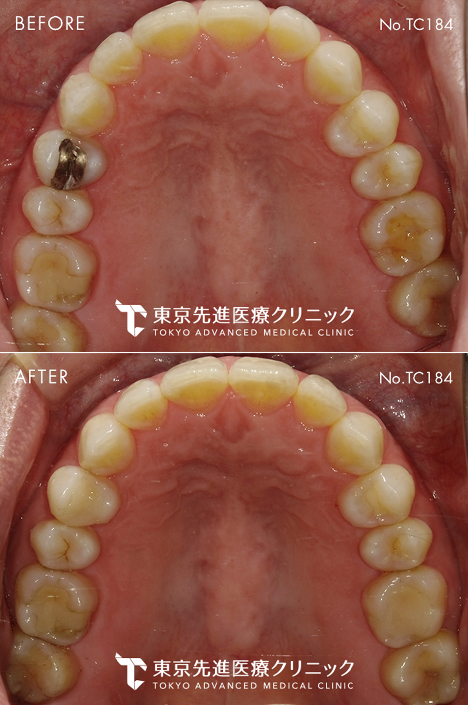 after